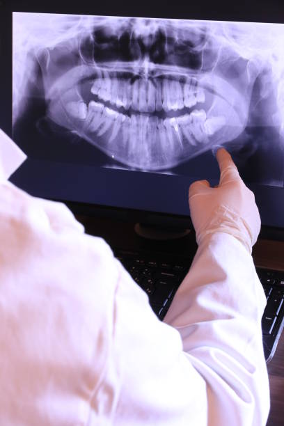Best Emergency Wisdom Teeth Removal in Manchester, PA